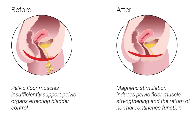 Glo Antiaging Calgary and Kelowna